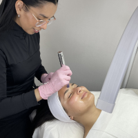 Limpieza facial + Peeling Antioxidante & Revitalizante con Dermapen